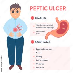 Nclex questions on peptic ulcer disease