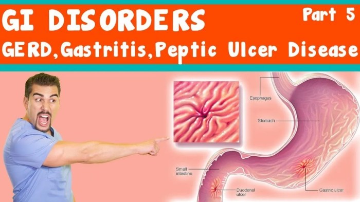 Nclex questions on peptic ulcer disease